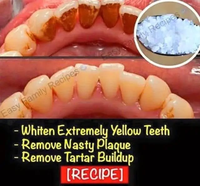 Titelbild für Maintain Your Teeth