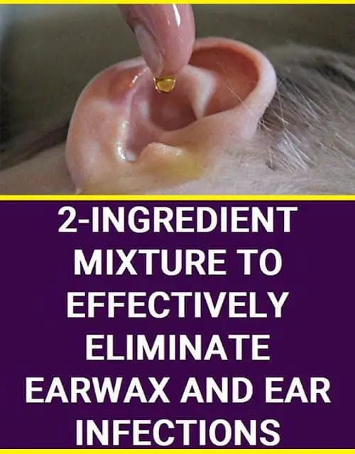 Titelbild für THESE TWO INGREDIENTS CAN ELIMINATE EARWAX AND EAR INFECTIONS